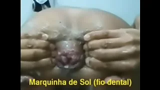 Alargando o cú depois que foi arrombado (20130130r) cdspbisexual